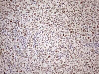 Immunohistochemistry: ATF1 Antibody (OTI2B4) - Azide and BSA Free [NBP2-70218]