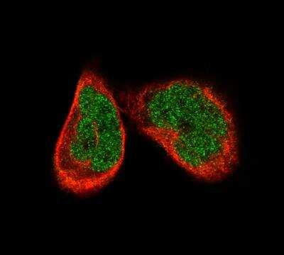Immunocytochemistry/ Immunofluorescence: ATF3 Antibody (CL1685) [NBP2-34489]