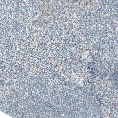 Immunohistochemistry-Paraffin: ATF3 Antibody (CL1685) [NBP2-34489]