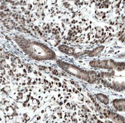 Immunohistochemistry-Paraffin: ATF3 Antibody (CL1685) [NBP2-34489]