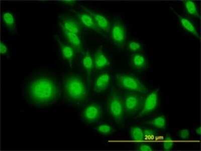 Immunocytochemistry/ Immunofluorescence: ATF4 Antibody (2B3) [H00000468-M01]