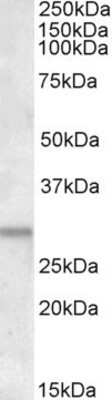 Western Blot: ATF5 Antibody [NBP1-51908]