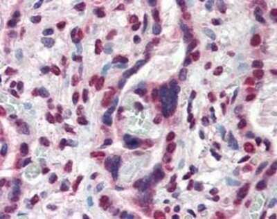 Immunohistochemistry-Paraffin: ATF6 Antibody (70B1413.1) - BSA Free [NBP1-40256]