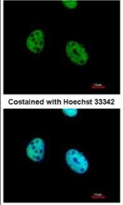 Immunocytochemistry/ Immunofluorescence: ATF7 Antibody [NBP1-30899]