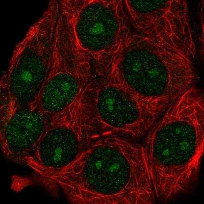 Immunocytochemistry/ Immunofluorescence: ATG10 Antibody [NBP2-38524]