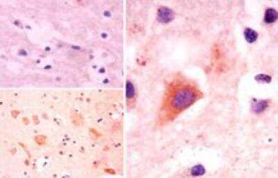 Immunohistochemistry-Paraffin: ATG10 Antibody [NBP2-24594]