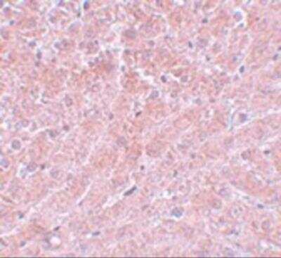 Immunohistochemistry: ATG101 Antibody - BSA Free [NBP2-81705]