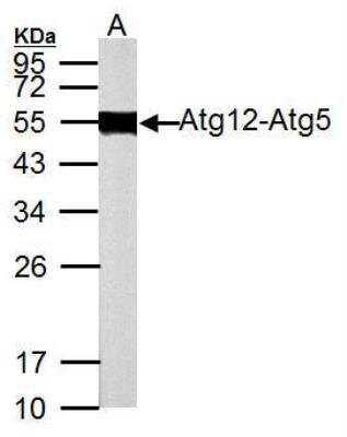 Western Blot: ATG12 Antibody [NBP2-15501]