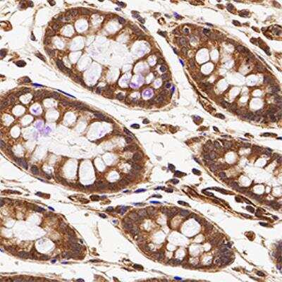 Immunohistochemistry-Paraffin: ATG16L1 Antibody - BSA Free [NB110-60928]