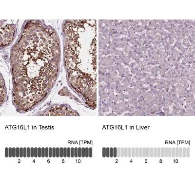 Immunohistochemistry-Paraffin: ATG16L1 Antibody [NBP2-49408]