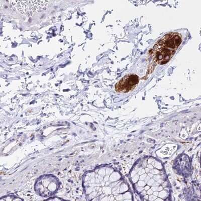Immunohistochemistry-Paraffin: ATG16L2 Antibody [NBP2-14326]