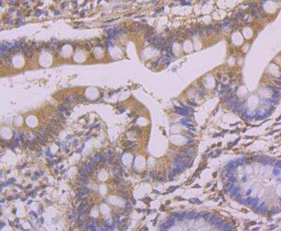 Immunohistochemistry-Paraffin: ATG3/APG3 Antibody [NBP3-09060]