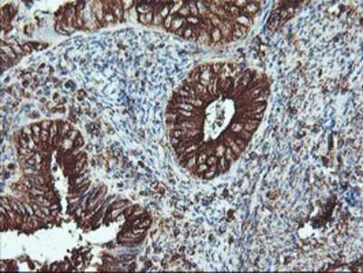 Immunohistochemistry: ATG3/APG3 Antibody (OTI3H2) - Azide and BSA Free [NBP2-72140]