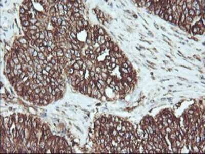 Immunohistochemistry: ATG3/APG3 Antibody (OTI3H2) - Azide and BSA Free [NBP2-72140]