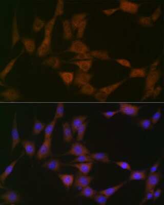 Immunocytochemistry/ Immunofluorescence: ATG4B Antibody (9H6M6) [NBP3-16538]