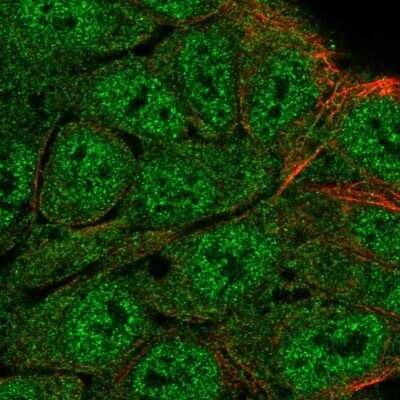 Immunocytochemistry/ Immunofluorescence: ATG4B Antibody [NBP2-57210]