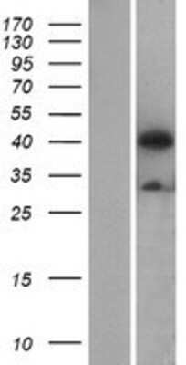 Western Blot: ATG4B Overexpression Lysate [NBP2-09850]