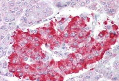 Immunohistochemistry-Paraffin: ATG4D Antibody [NBP1-36939]