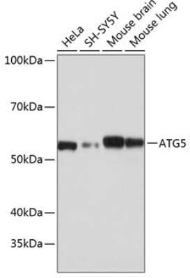 Western Blot: ATG5 Antibody (8L7X6) [NBP3-15854]