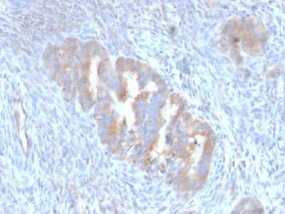 Immunohistochemistry-Paraffin: ATG5 Antibody (ATG5/2101) [NBP3-07889]