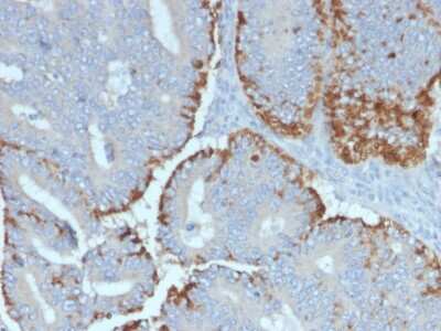 Immunohistochemistry-Paraffin: ATG5 Antibody (ATG5/2492) [NBP3-07879]
