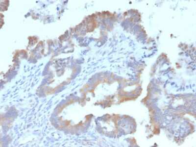 Immunohistochemistry-Paraffin: ATG5 Antibody (ATG5/2492) [NBP3-07879]