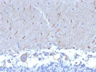 Immunohistochemistry-Paraffin: ATG5 Antibody (ATG5/2553) - Azide and BSA Free [NBP3-08434]