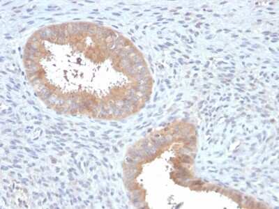 Immunohistochemistry-Paraffin: ATG5 Antibody (ATG5/2553) [NBP3-07880]