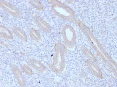 Immunohistochemistry-Paraffin: ATG5 Antibody (ATG5/2553) [NBP3-07880]