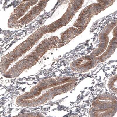 Immunohistochemistry-Paraffin: ATG5 Antibody (CL9508) [NBP2-88936]