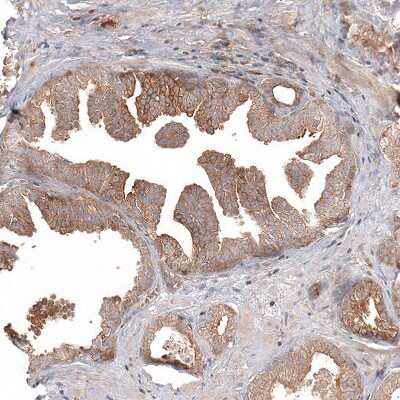Immunohistochemistry-Paraffin: ATG5 Antibody (CL9508) [NBP2-88936]