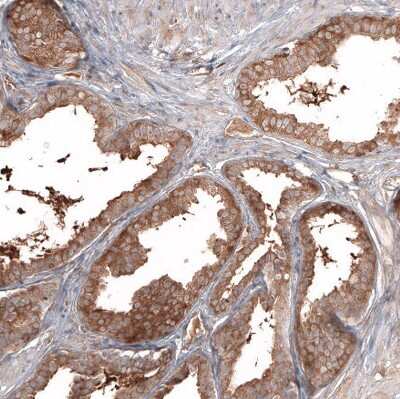 Immunohistochemistry-Paraffin: ATG5 Antibody (CL9508) [NBP2-88936]