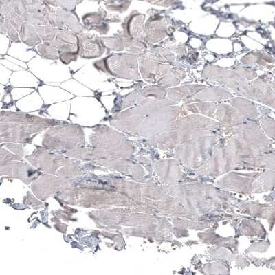 Immunohistochemistry-Paraffin: ATG5 Antibody (CL9508) [NBP2-88936]