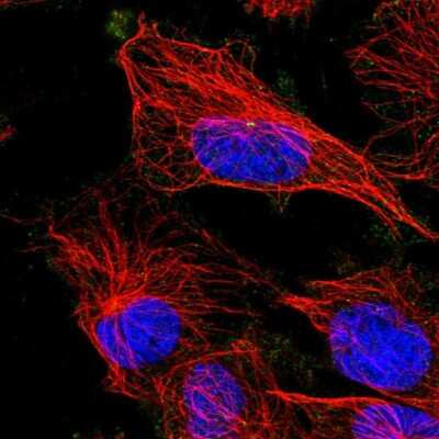 Immunocytochemistry/ Immunofluorescence: ATG5 Antibody [NBP2-54702]