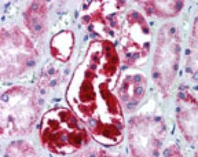 Immunohistochemistry-Paraffin: ATG5 Antibody - BSA Free [NBP2-24389]