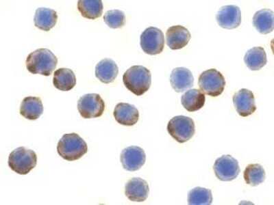 Immunocytochemistry/ Immunofluorescence: ATG7 Antibody - BSA Free [NBP1-76649]
