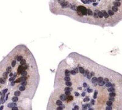 Immunohistochemistry: ATG9A Antibody - BSA Free [NB110-56893]