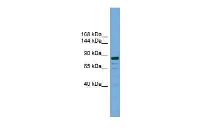 Western Blot: ATG9B Antibody [NBP2-88772]