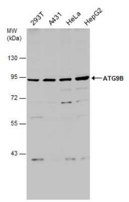 Western Blot: ATG9B Antibody [NBP3-13108]