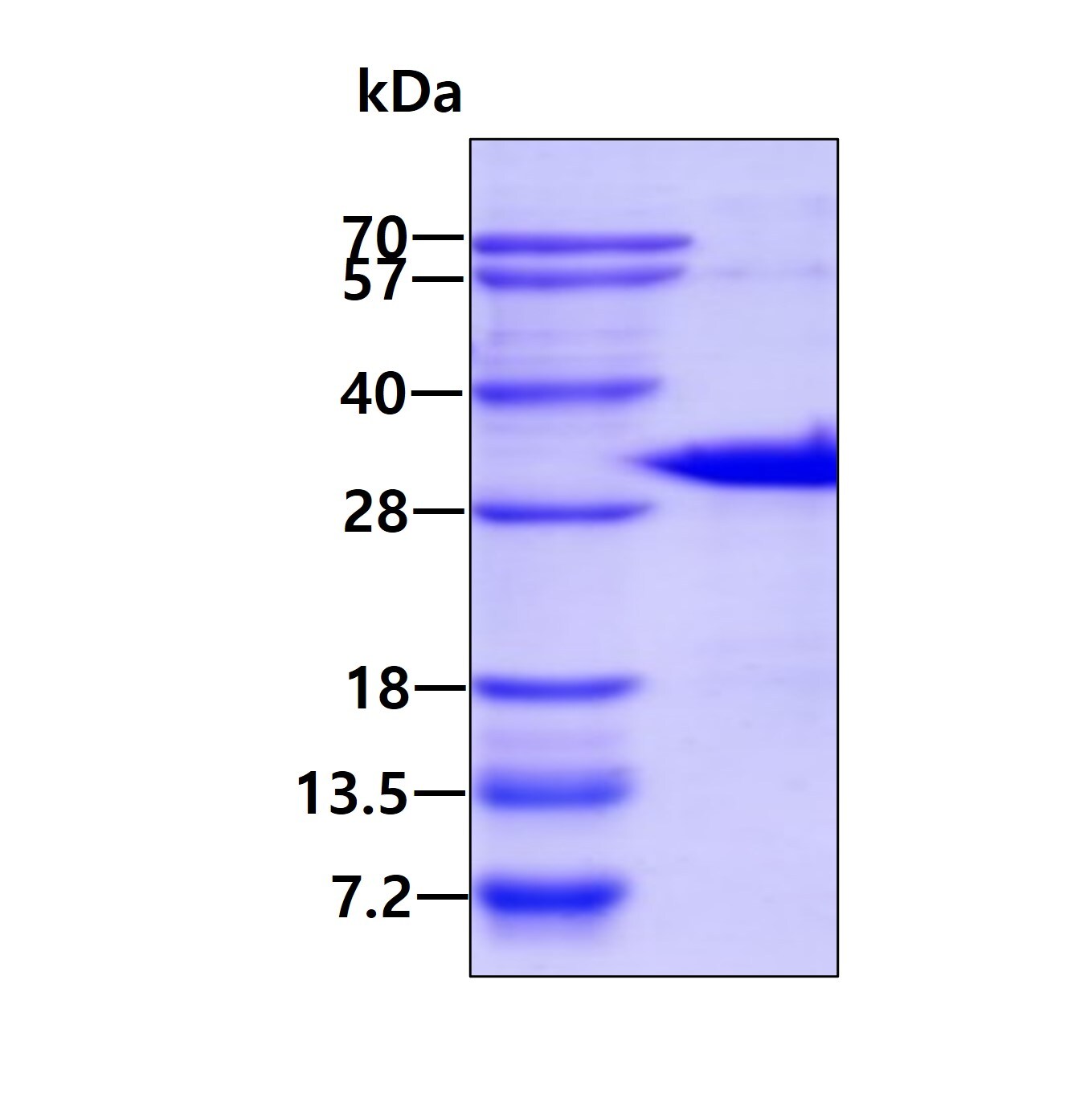 SDS-PAGE: Recombinant Human Cited-2 His Protein [NBC1-28611]