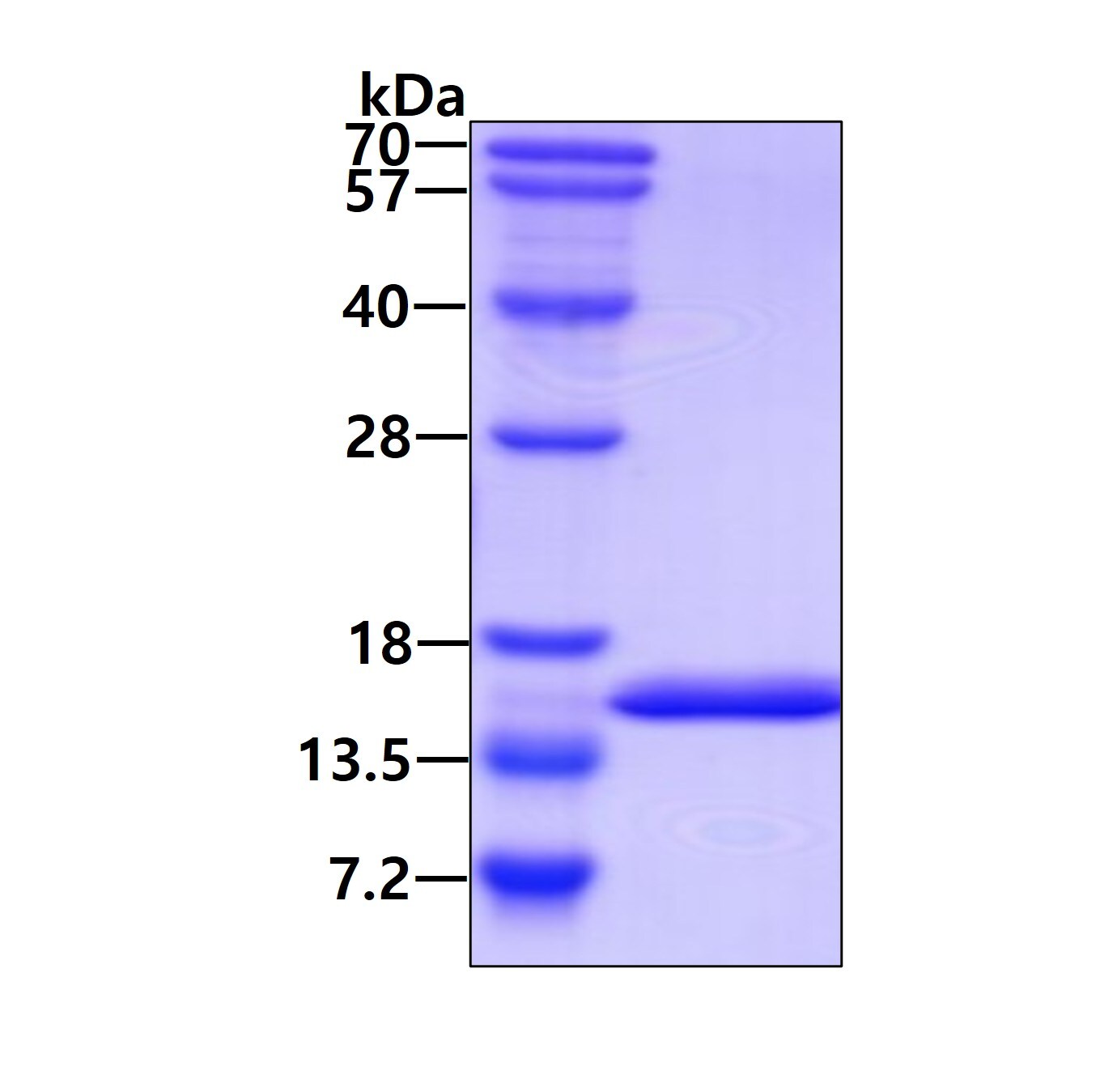 SDS-PAGE: Recombinant Human ROBLD3 His Protein [NBP1-50918]