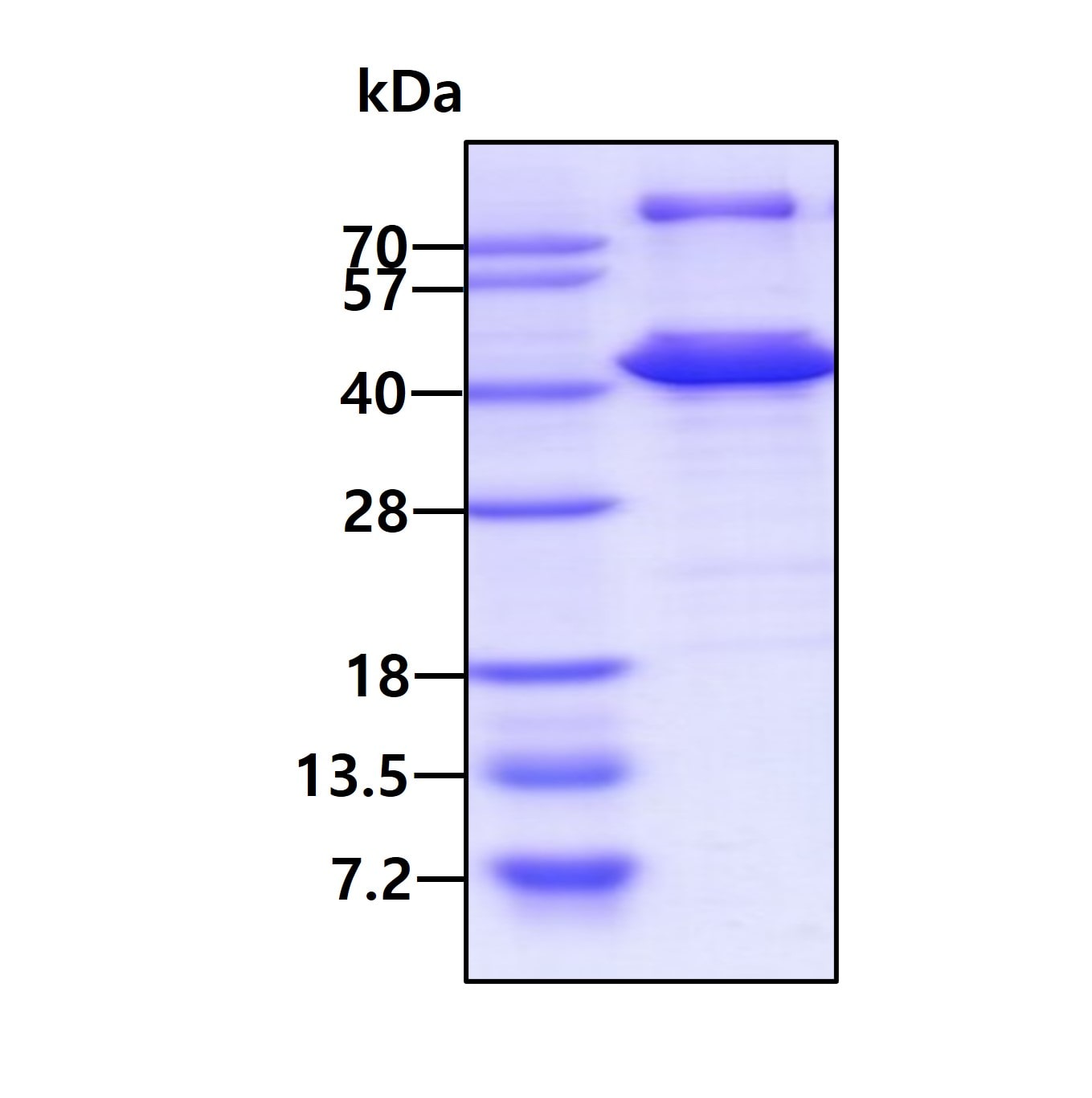 SDS-PAGE: Recombinant Human tropomyosin-2 His Protein [NBP1-50957]