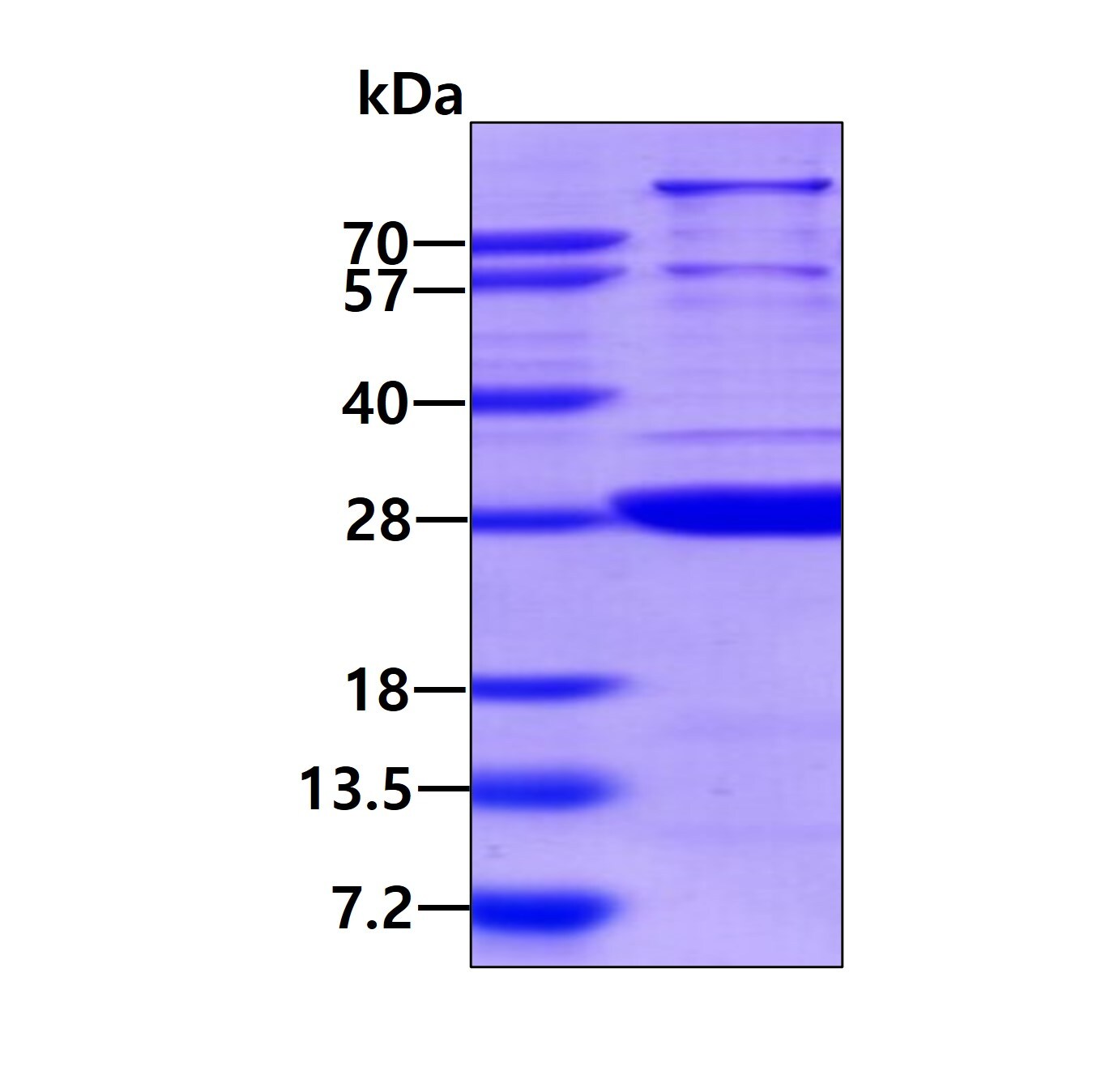 SDS-PAGE: Recombinant Human SPSB1 His Protein [NBP1-72302]