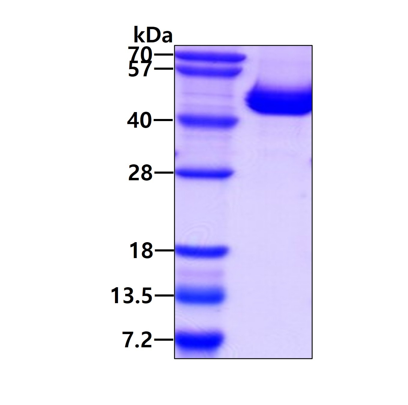 SDS-PAGE: Recombinant Human IL12B His Protein [NBP1-99042]