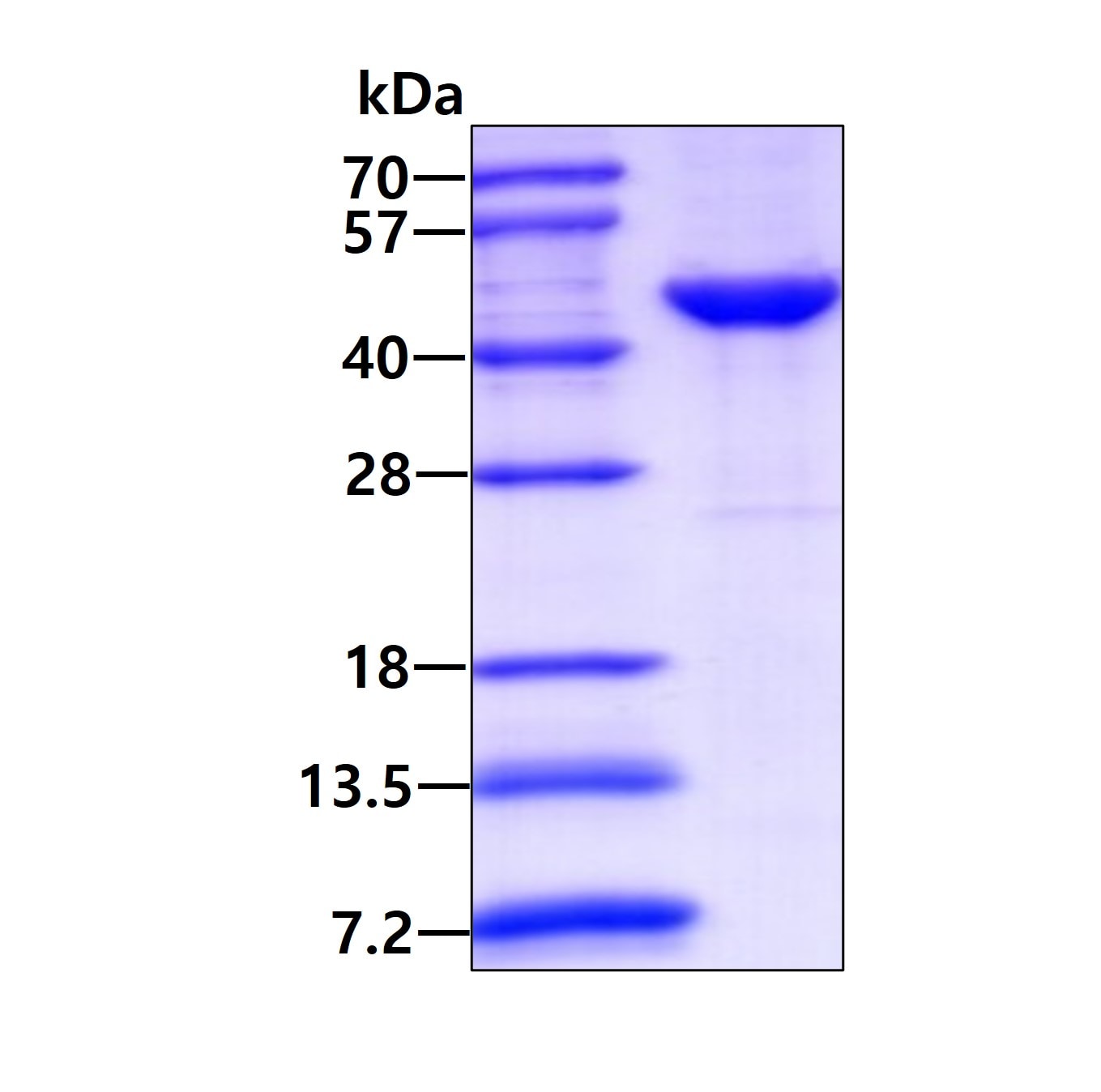 SDS-PAGE: Recombinant Human CKII alpha prime polypeptide His Protein [NBP2-22736]