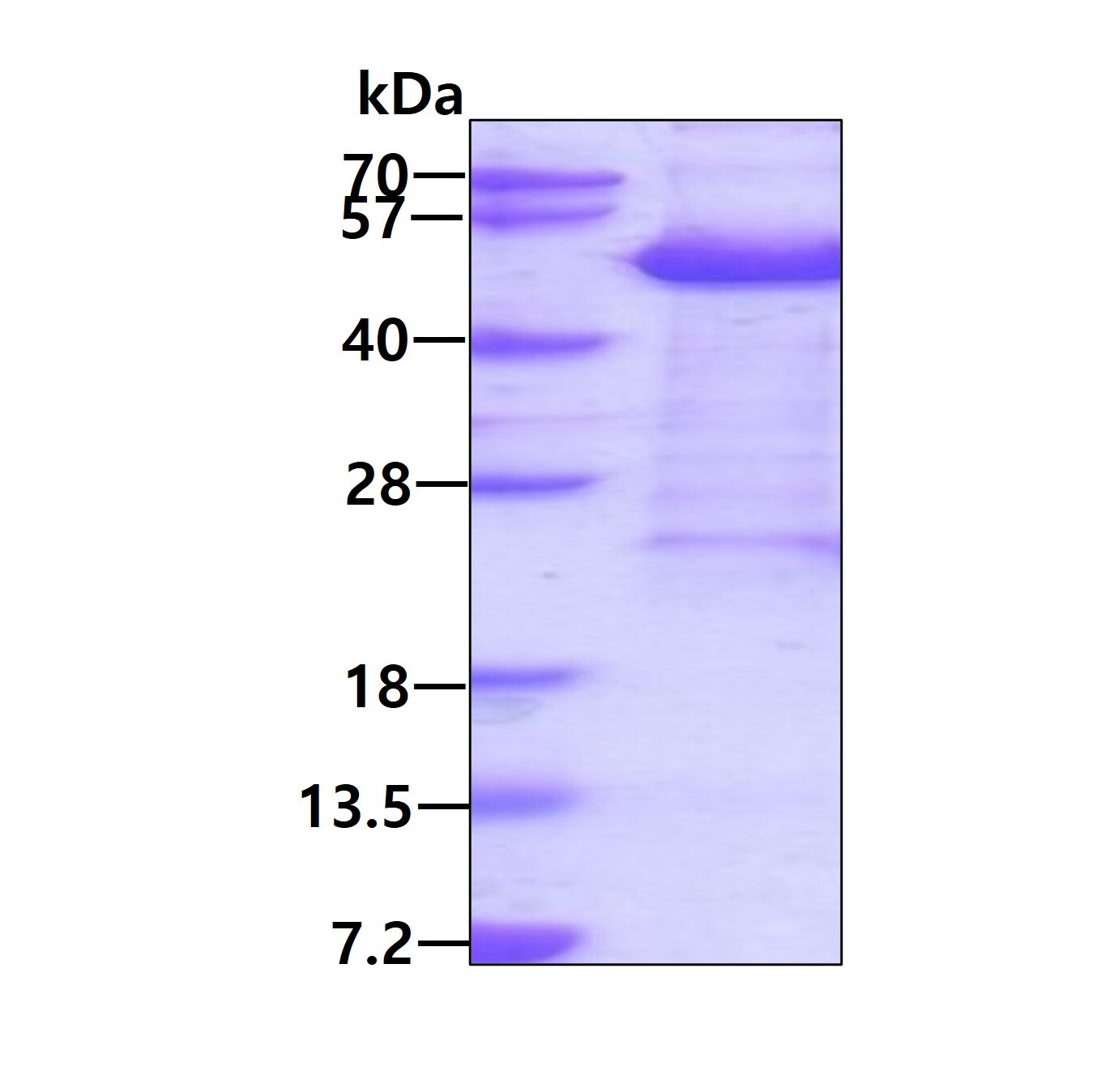 SDS-PAGE: Recombinant Human KIN His Protein [NBP2-23174]
