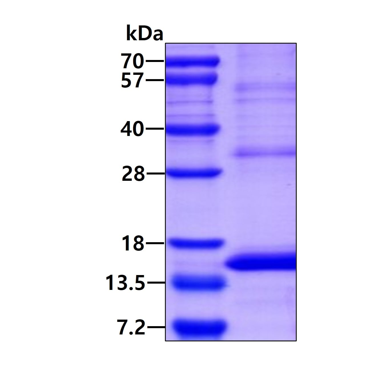 SDS-PAGE: Recombinant Human GP-IX His Protein [NBP2-23083]