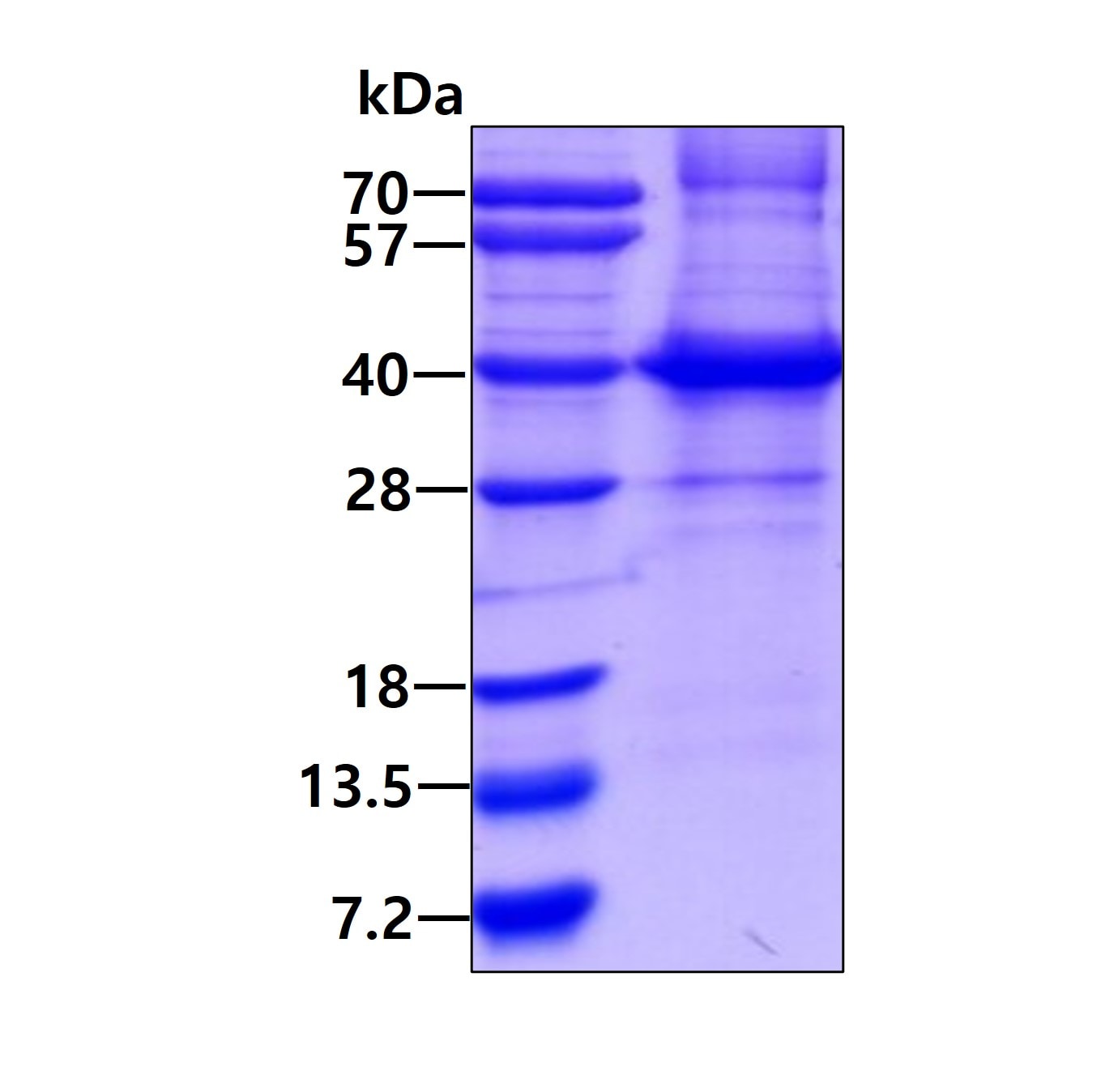 SDS-PAGE: Recombinant Human HLA C His Protein [NBP2-23210]