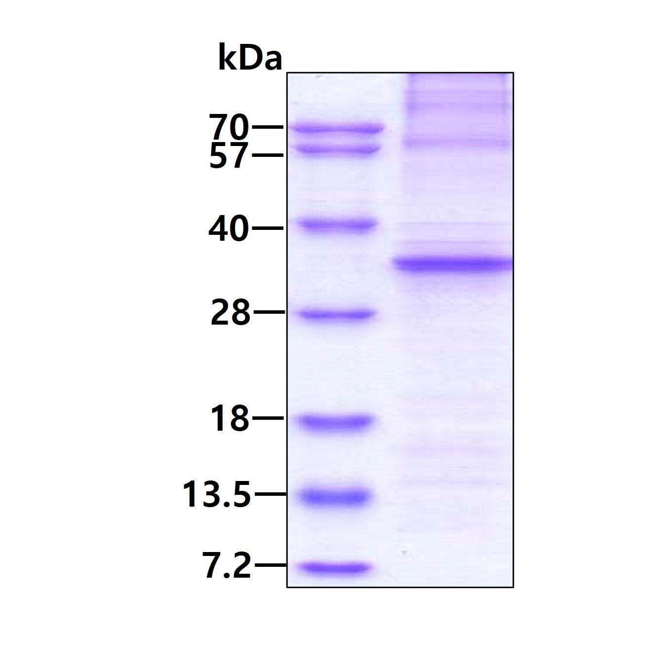 SDS-PAGE: Recombinant Human AMPK alpha 1 His Protein [NBP2-51992]
