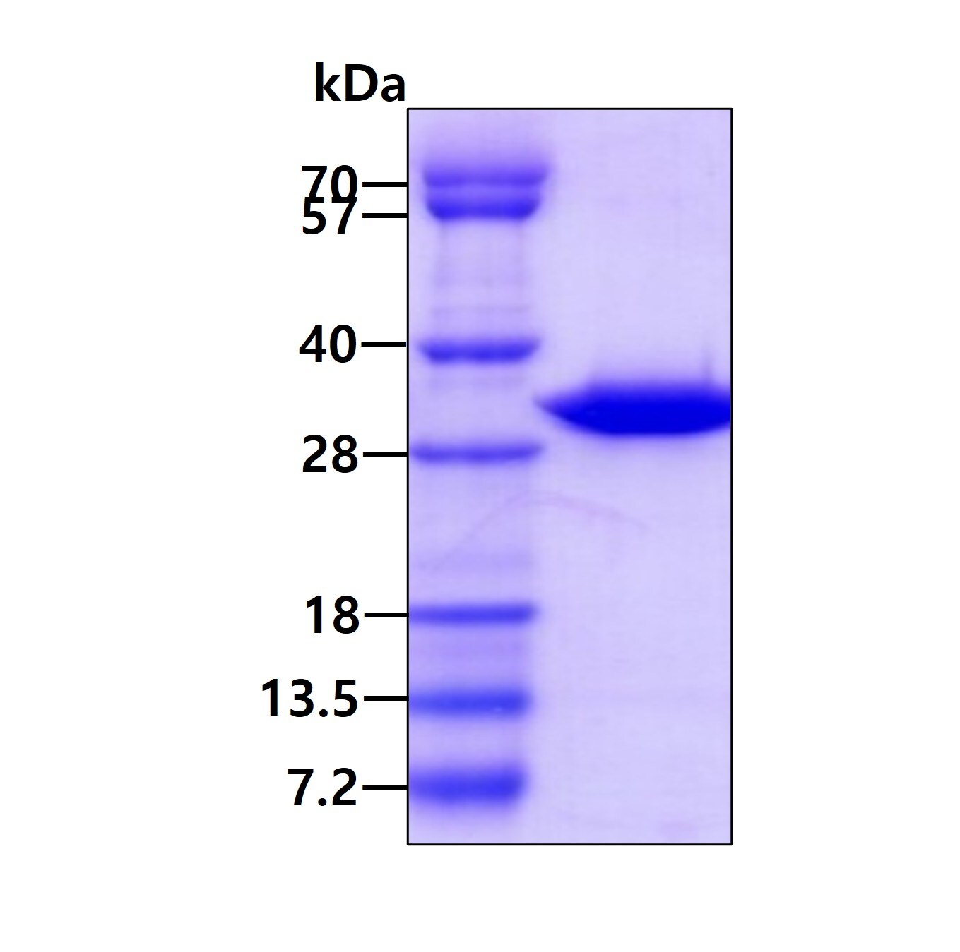 SDS-PAGE: Recombinant Mouse AK2 His Protein [NBP2-61201]
